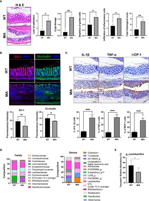 Lactobacillus (LA-1) and butyrate inhibit osteoarthritis by controlling autophagy and inflammatory cell death of chondrocytes